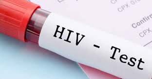 درمان موثر می تواند ایپدمی HIV را مهار کند