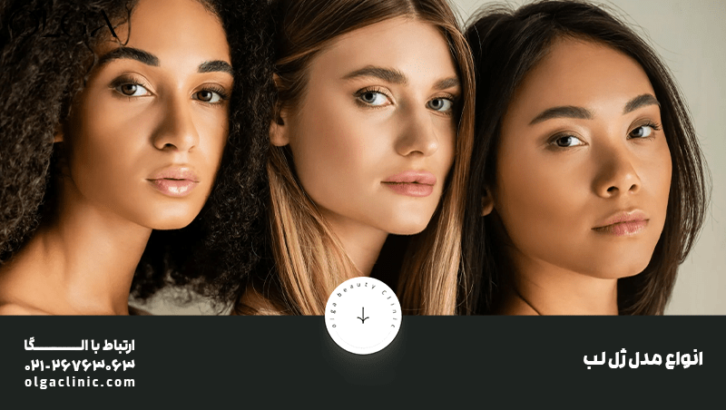 باتری | زیبایی لیست زیباترین و پرطرفدارترین انواع فرم لب با ژل