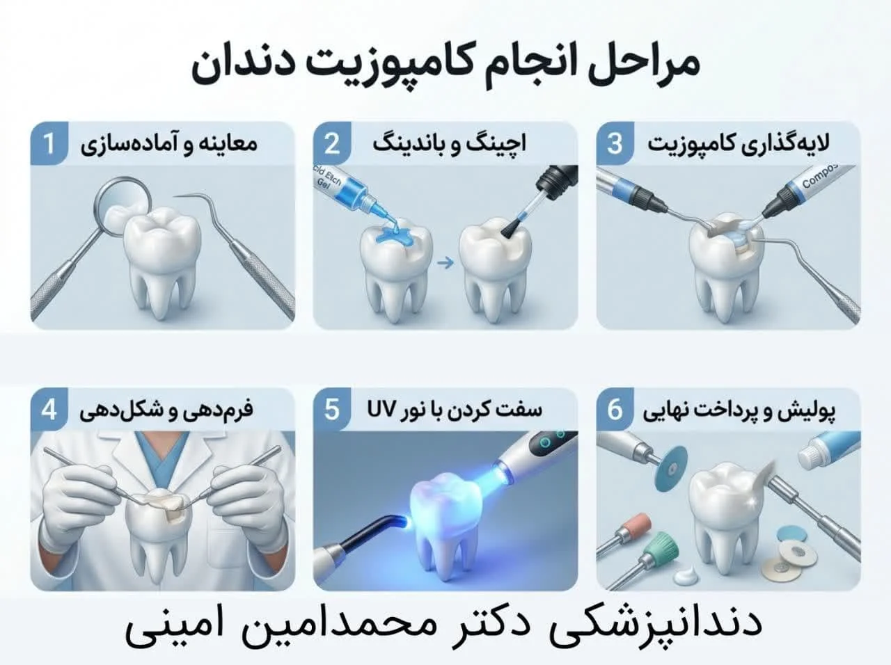 مراحل انجام کامپوزیت دندان دندانپزشکی دکتر امینی